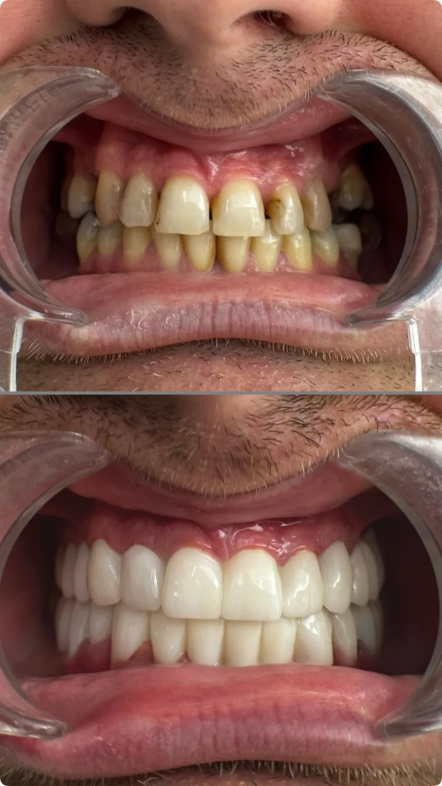 Before / After