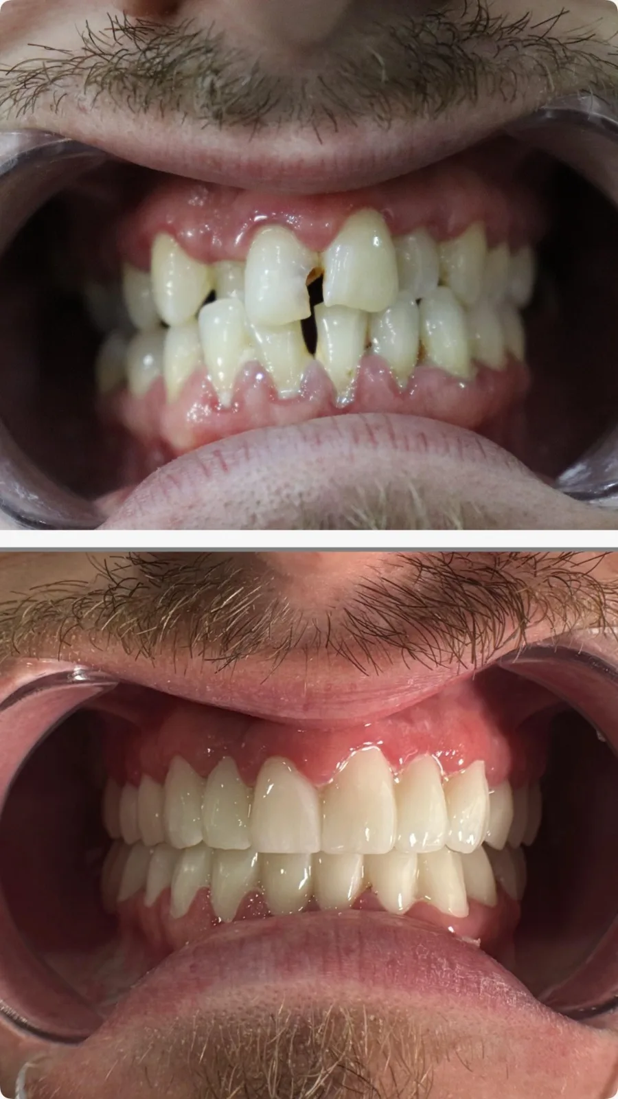 Before / After