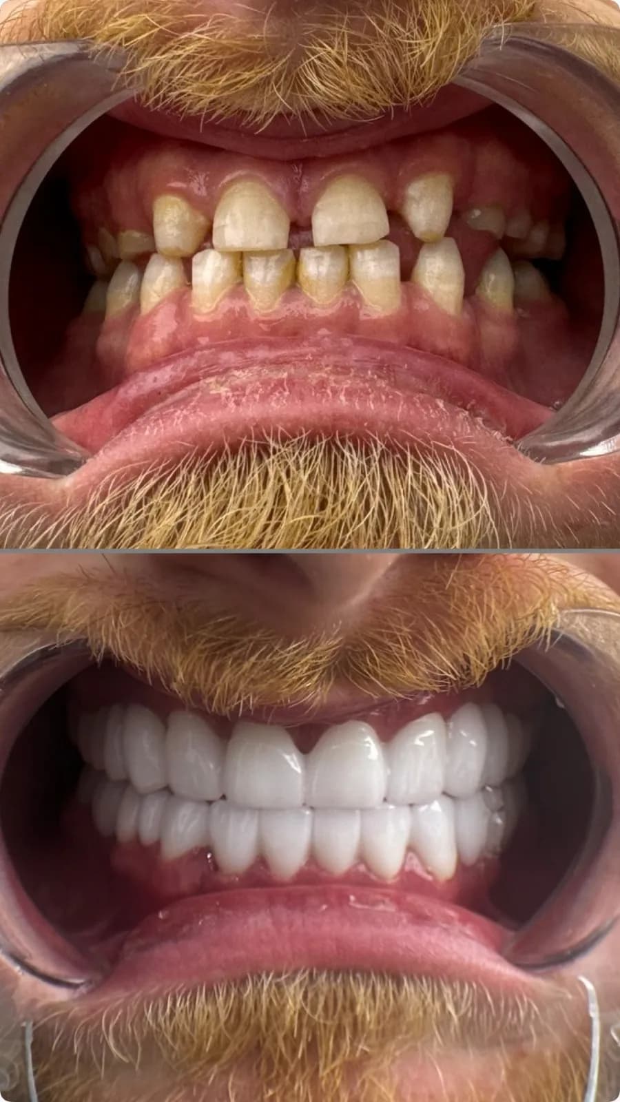 Before / After