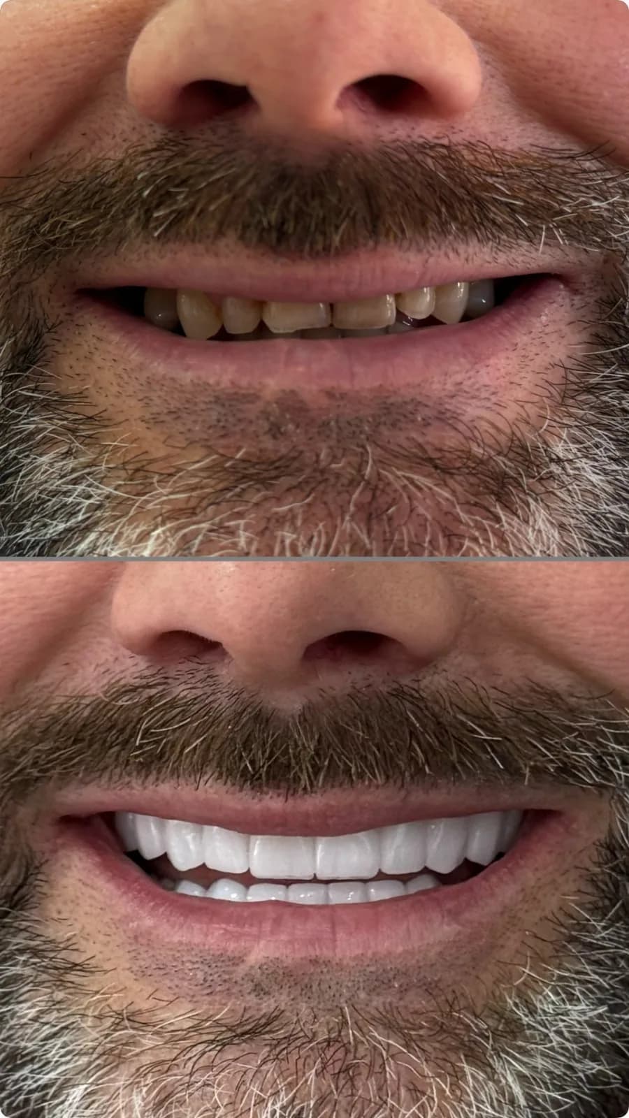 Before / After