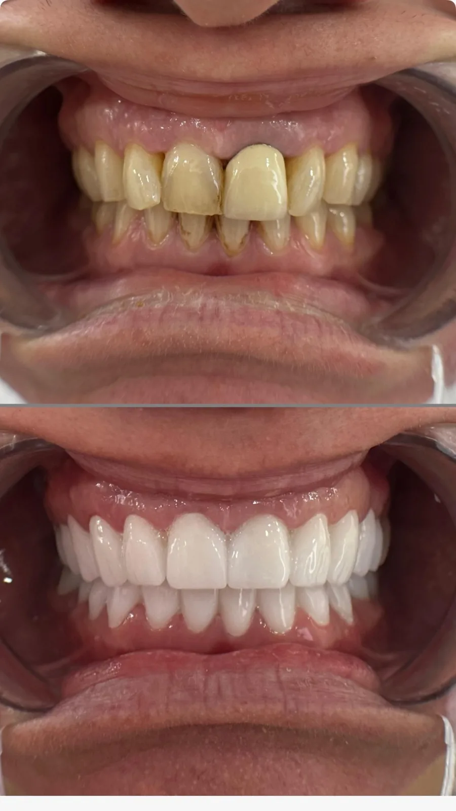 Before / After