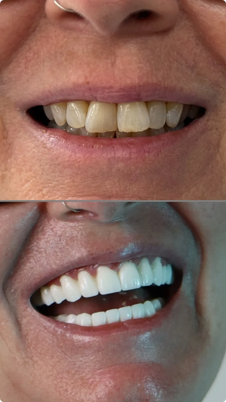 Before / After